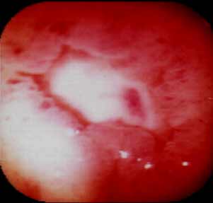 θ