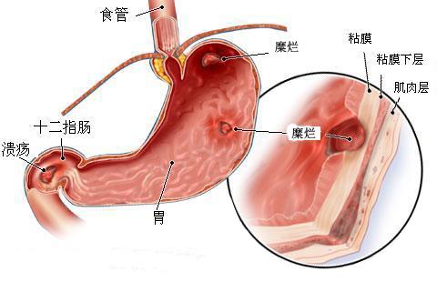 θ