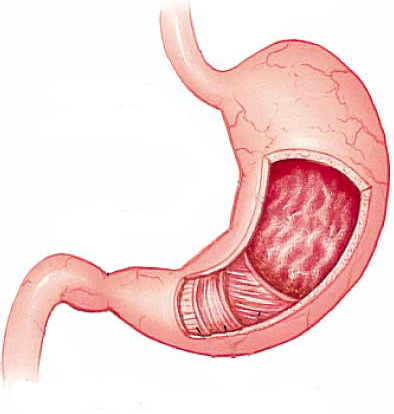 θ