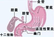 θ